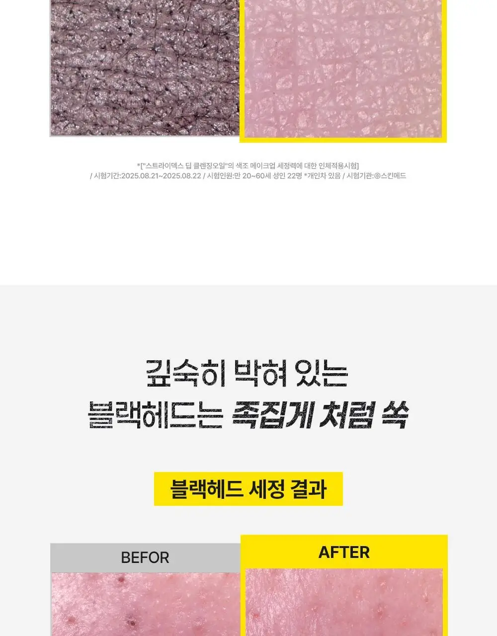 [놓치면끝] 스트라이덱스 포어 리셋 딥 클렌징오일 200ml 상세페이지 18